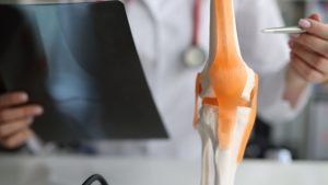 prevenção da artrose, artrose, tratamento da artrose em aveiro, fisioterapeuta em aveiro, tratamento da dor em aveiro, fisioterapia em aveiro
